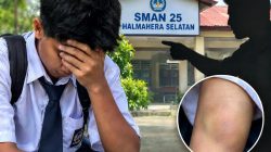 Terlambat ke Sekolah, Siswa SMAN 25 Diduga Dianiaya Oknum Guru hingga Alami Memar