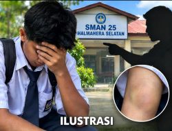 Terlambat ke Sekolah, Siswa SMAN 25 Diduga Dianiaya Oknum Guru hingga Alami Memar